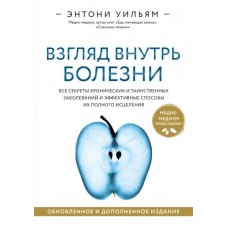 Взгляд внутрь болезни. Все секреты хронических и таинственных заболеваний Взгляд внутрь болезни. Все секреты хронических и таинственных заболеваний
