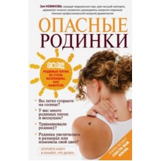 Опасные родинки. Зоя Новикова